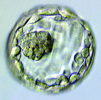 Blastocyst