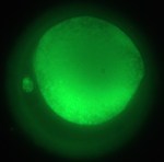 Mitochondrial transfer