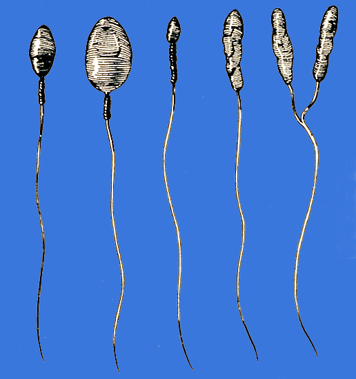 sperm quality