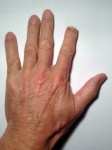 Lost a fingertip? Call an axolotl.